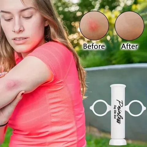 Ferramenta de sucção para picadas de insetos, extrator de veneno, alívio da coceira, redução natural da coceira e do inchaço, primeiros socorros para picadas e mordidas em atividades ao ar livre, como caminhadas, para uso nas costas.