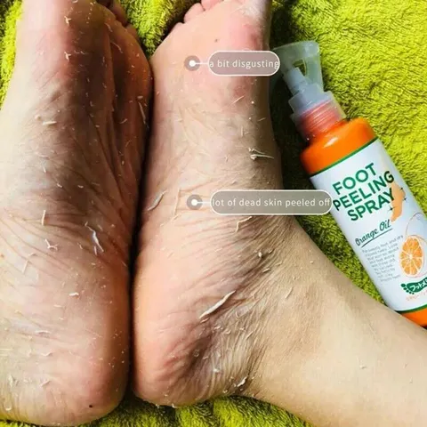 Removedor de Cutículas para os Pés 100ML, Esfoliante e Amaciador para Remover Pele Morta e Calosidades, Máscara para os Pés, Potencializador de Unhas para Pedicure