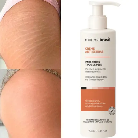 Creme AntiEstrias Removedor Estrias 200g Morena Brasil – Ação Poderosa com Colágeno e Elastina