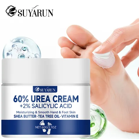 SUYARUN Creme para pés de ureia 60% para calcanhares rachados e pele seca - Tratamento hidratante intensivo, removedor de calos, cuidados com os pés diabéticos.